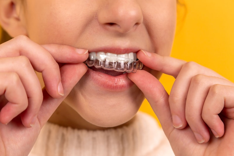Dentist performing a professional teeth cleaning